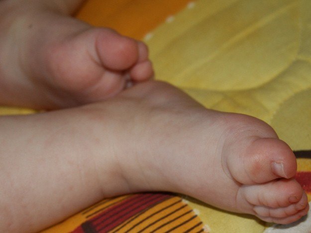 Hilfe f&uuml;r die F&uuml;&szlig;e