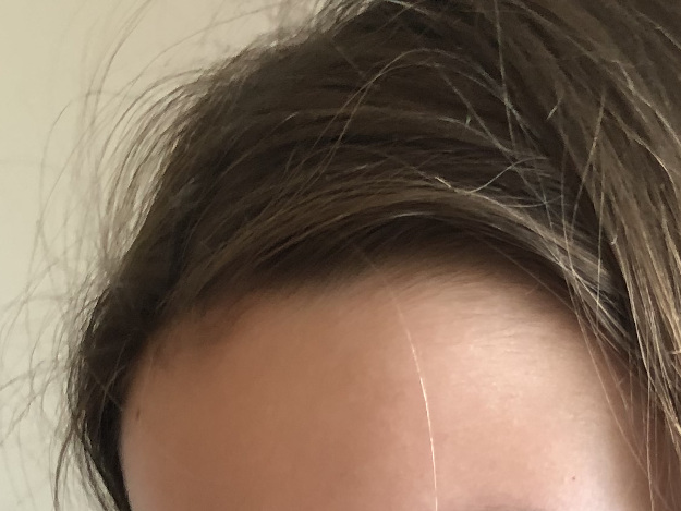 Was hilft wirklich gegen Krähenfüße & Co. Frau