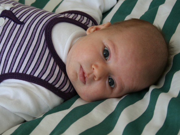 Manchmal kann Neugeborenenakne, Milien, Storchenbiss oder Milchschorf auftreten. Baby